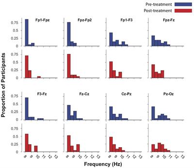 Pilot Testing of Peak Alpha Frequency Stability During Repetitive Transcranial Magnetic Stimulation